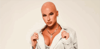 Runway-Magazine-Interview-Chloe Bean Inspiring Alopecia Journey and Empowerment Tips